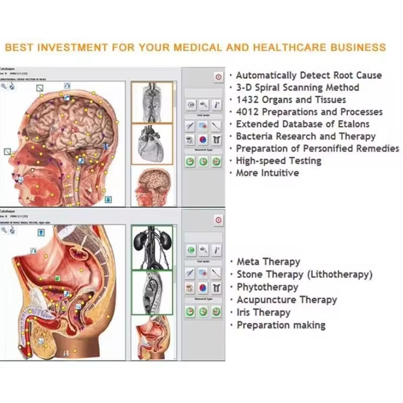 Metatron Hunter 4025 NLS Biore - Holistic Health & Wellness review and price